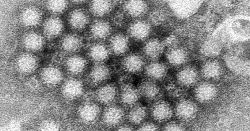 Laut CDC nehmen die Norovirus-Ausbrüche in einigen Bundesstaaten zu