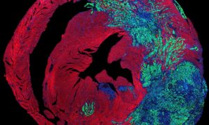 Krebs ist im Herzen irgendwie selten. Es stellt sich heraus, dass der rhythmische Rhythmus des Organs die Krankheit in Schach halten könnte, wie eine Mausstudie zeigt